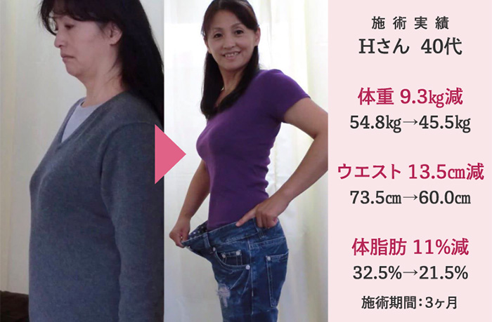 施術実績 Aさん  40代 体重 ８.3㎏減 74.8㎏→66.5㎏ エスト 13.9㎝減 90.9㎝→77.0㎝ 体脂肪 13%減 26.5%→13.5% 施術期間：３ヶ月